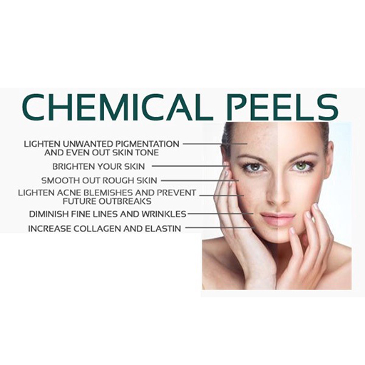 chemical peels